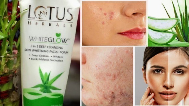 '#Lotus #Herbals Face Wash | Best Face Wash for Women | Skin Care'