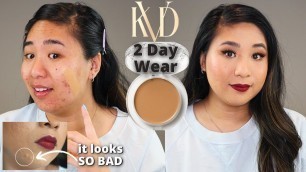 '2 Day Wear Test on KVD Beauty Good Apple Foundation Balm on OILY & ACNE Skin'