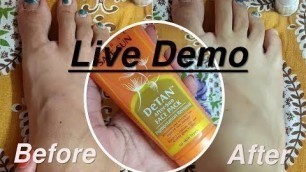 'Lotus Herbals Safe sun de-tan pack review and live demo on affected area.'