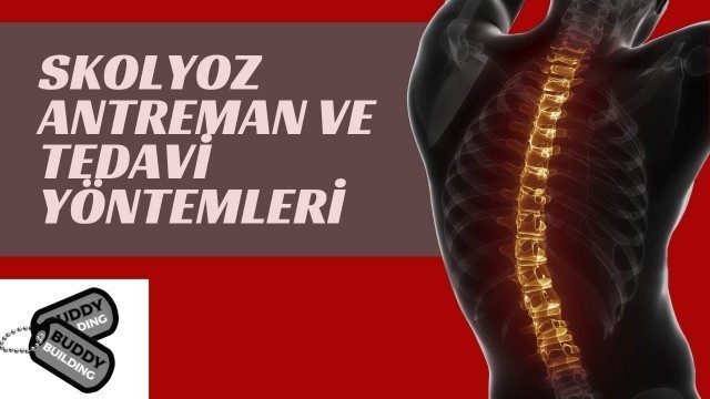 'SKOLYOZ TEDAVİ VE  ANTRENMAN ÖNERİLERİ'