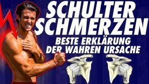 'SCHULTERSCHMERZEN ERKLÄRT! - Schulter Impingement loswerden, was tun? Training Fitness Verspannungen'