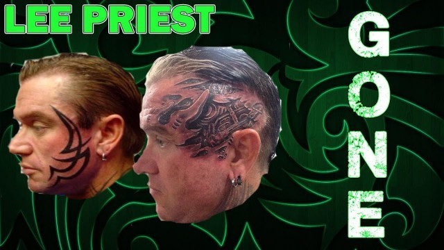'LEE PRIEST Is The FACE TATTOO Being Removed?'