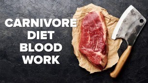 'Year on Carnivore Diet - Shawn Baker Blood Work | They Aren\'t Bad! | Tiger Fitness'